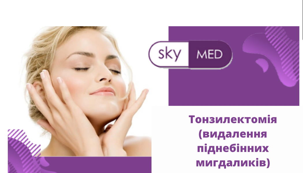 Видалення мигдаликів у Дніпрі в медичному центрі SKY MED